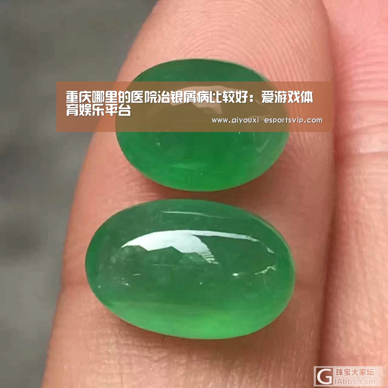 重庆哪里的医院治银屑病比较好:爱游戏体育娱乐平台(图2) 爱游戏体育赛事直播